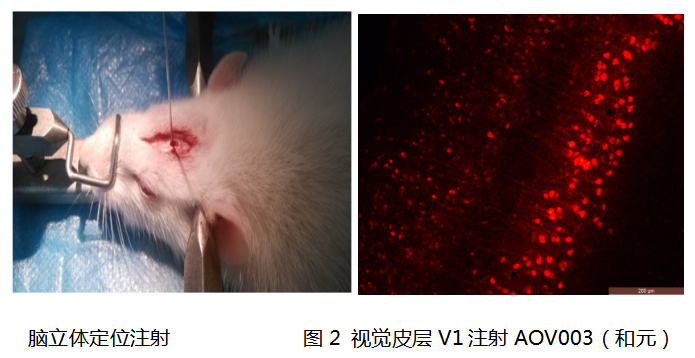 神经系统疾病动物模型 和元生物